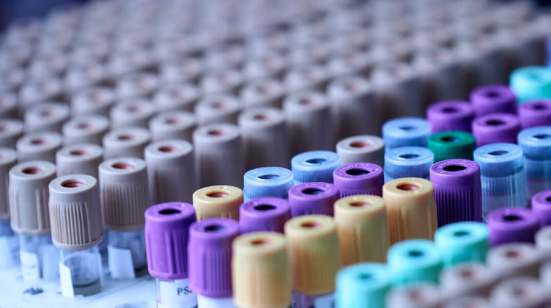 20 τα κρούσματα στην Ελλάδα που αφορούν στην ευλογιά των πιθήκων