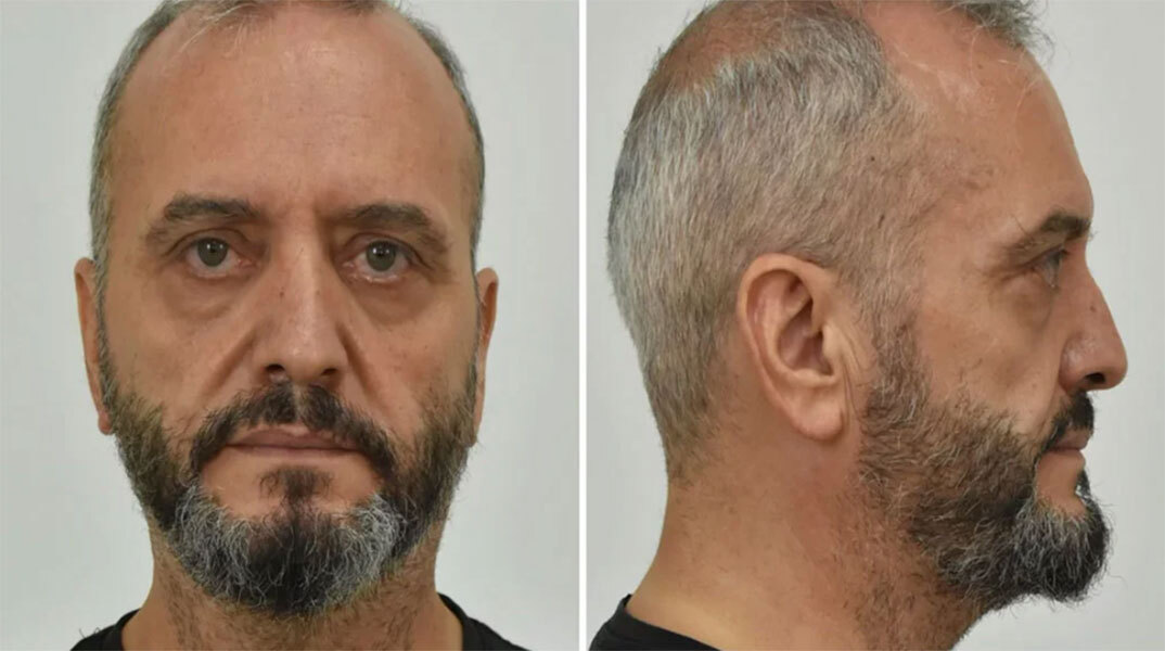 Ο 53χρονος στον Κολωνό που βίαζε και εξέδιδε τη 12χρονη μαθήτρια