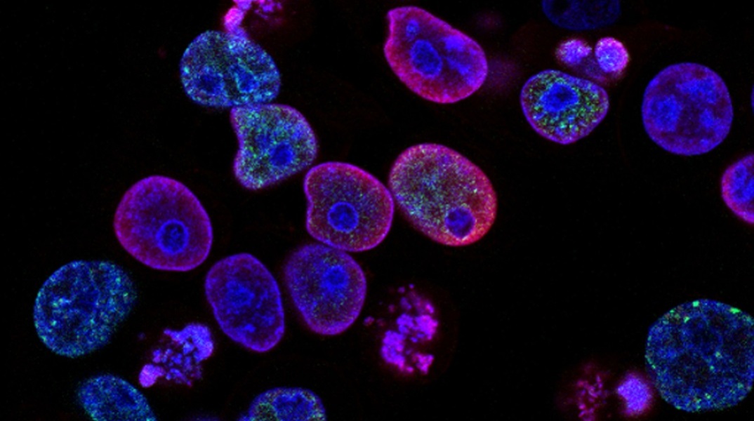 Νέα θεραπεία «άλμα προς τα εμπρός» στην προσαρμοσμένη ιατρική για τον καρκίνο