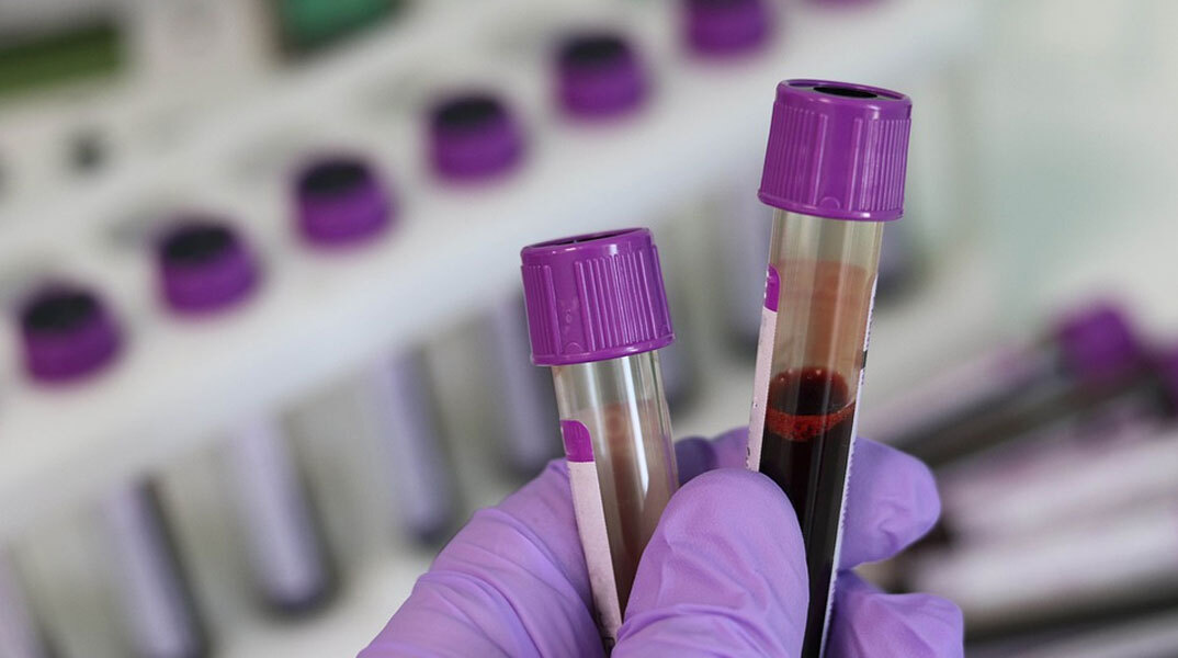 Αναπτύχθηκε «έξυπνο» τεστ αίματος που ανιχνεύει τον καρκίνο στο ήπαρ