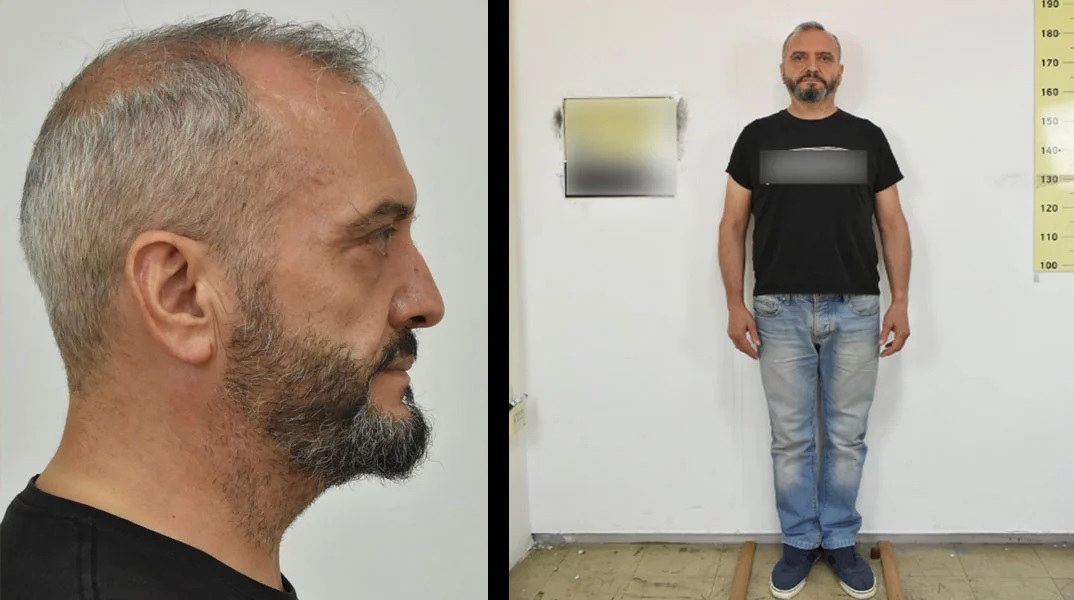  «Βλέπει εφιάλτες με τον Μίχο» λέει η θεία της 12χρονης στον Κολωνό