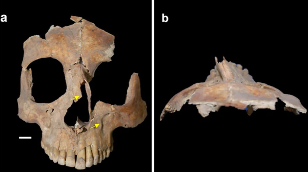 Βρέθηκε κρανίο με τετράγωνη τρύπα στο Ισραήλ