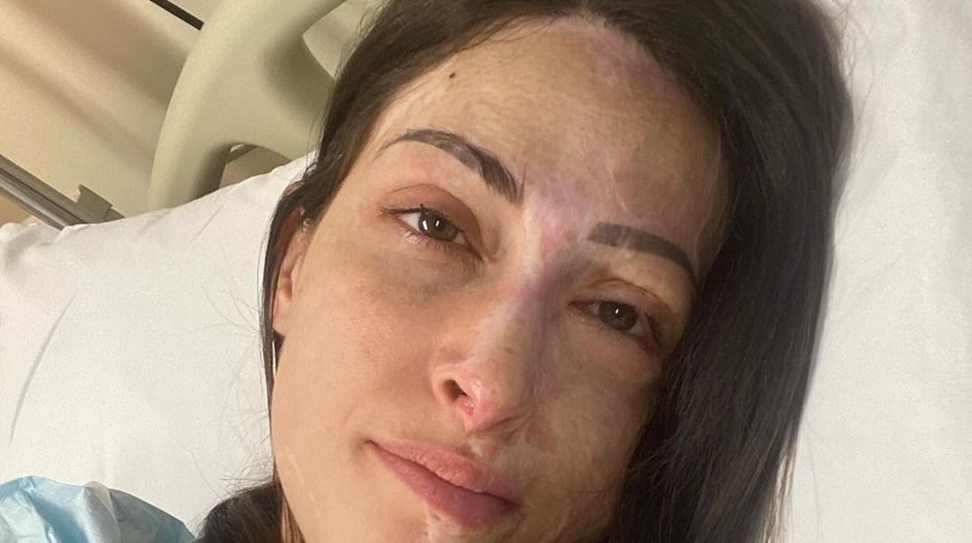 Ιωάννα Παλιοσπύρου: «Πλέον όλα έχουν ως σκοπό τη βελτίωση και όχι να μου σώσουν τη ζωή»