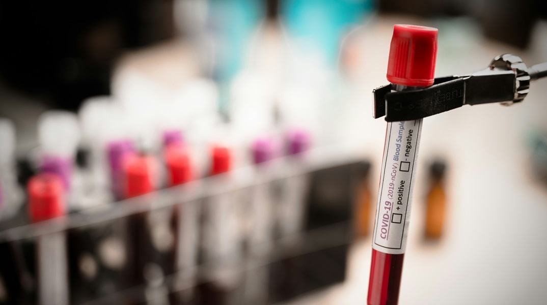 Μαγιορκίνης για κορονοϊό: Έως τέλος Ιανουαρίου η κορύφωση της έξαρσης της Covid-19 - Έχει υποτιμηθεί το ενισχυμένο εμβόλιο