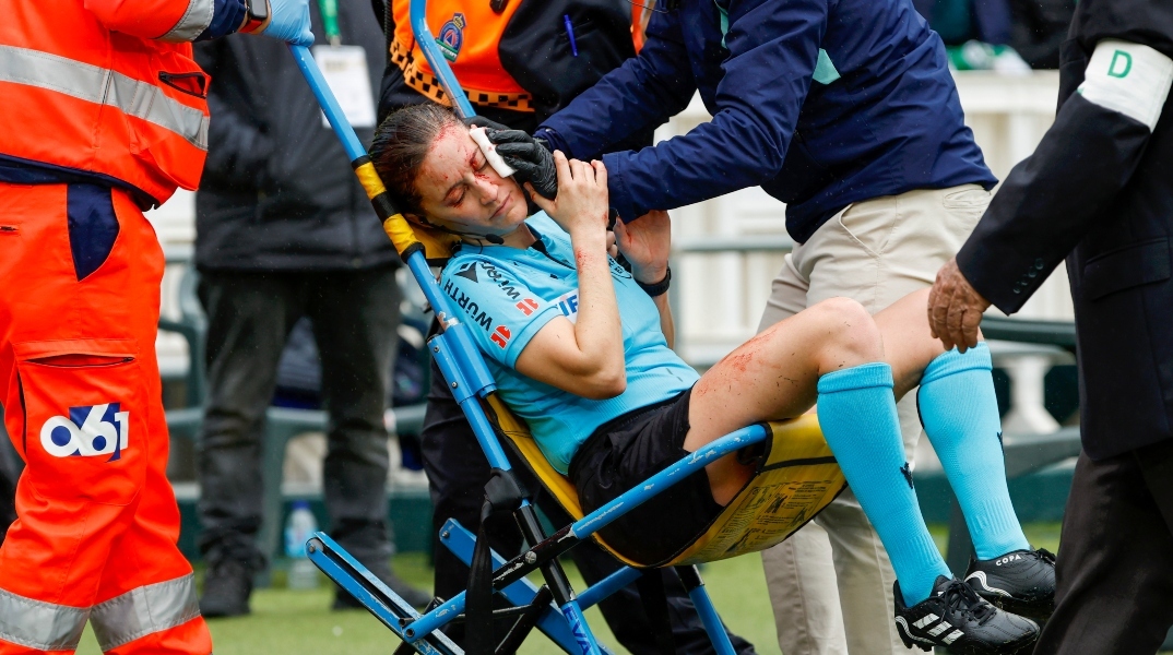 Αιμόφυρτη έφυγε από το γήπεδο γυναίκα διαιτητής μετά από σφοδρή σύγκρουση με κάμερα 