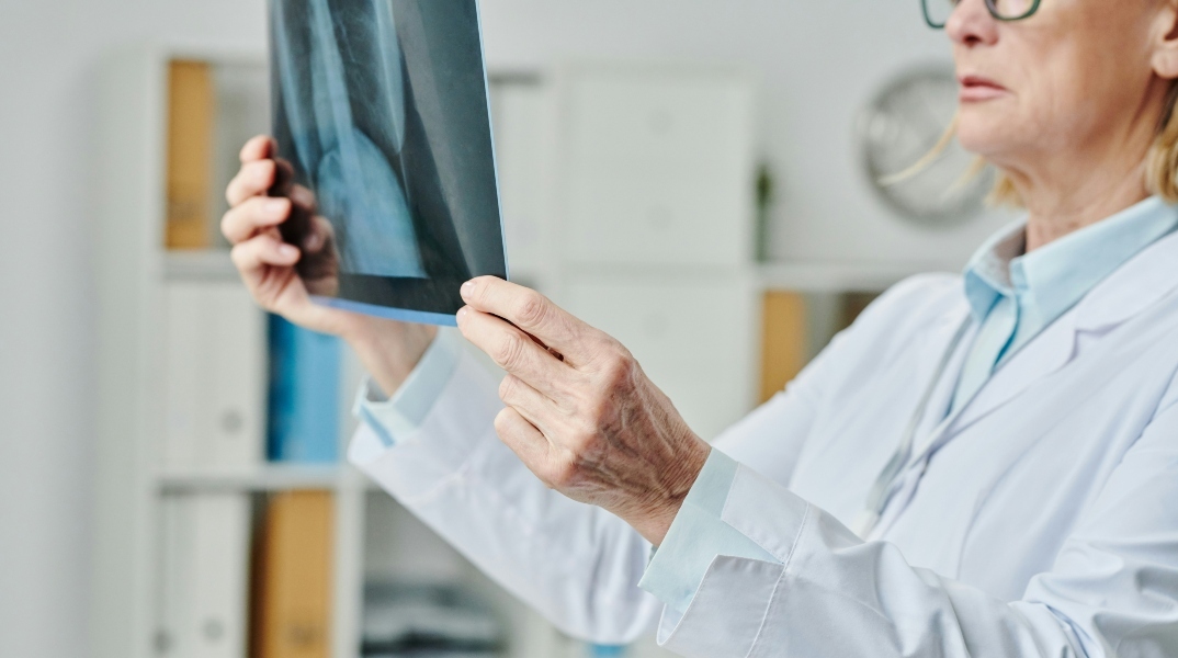 Γιατρός εξετάζει ακτινογραφία