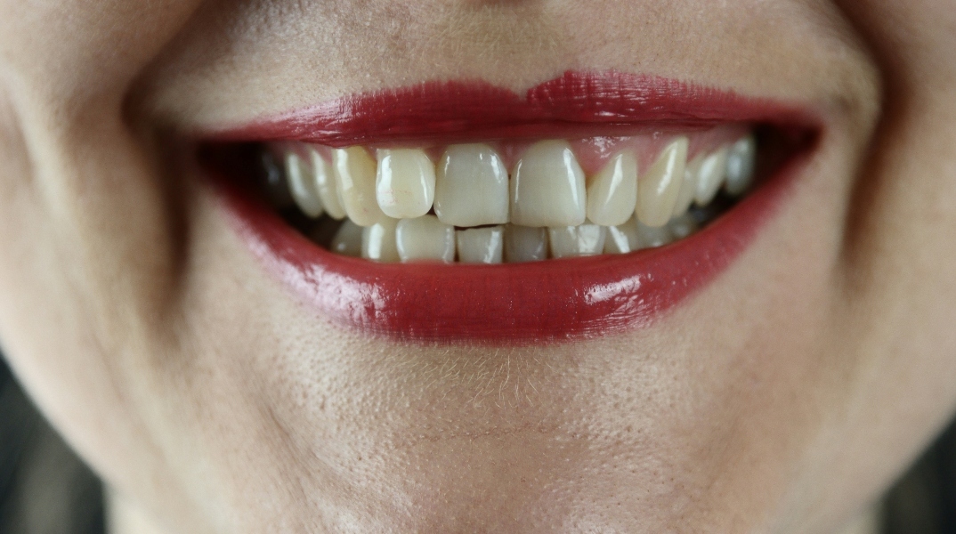 Κίτρινα δόντια: τα δύο λάθη που καταστρέφουν το χαμόγελό σας