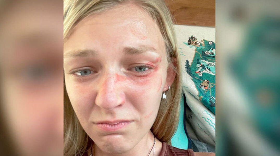 Η ιστορία της Γκάμπι Πετίτο που έγινε ντοκιμαντέρ στο Netflix