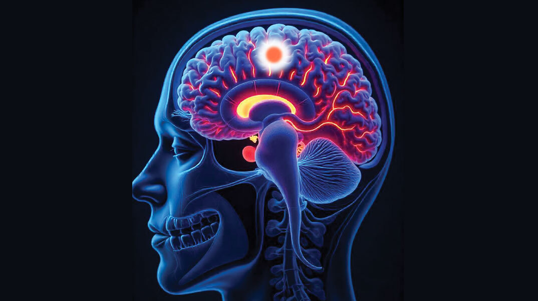 Στερεοτακτική Ακτινοχειρουργική