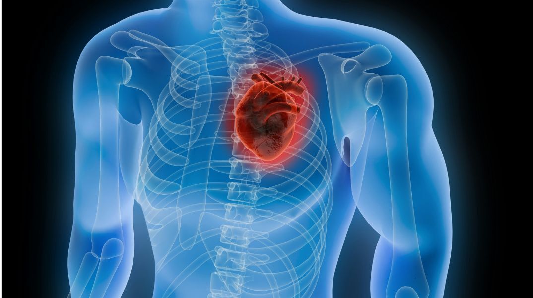 Συνδυασμός στατινών και εζετιμίμπης μειώνει θανάτους και καρδιακά επεισόδια μετά από καρδιακή προσβολή, προτείνει νέα επιστημονική μελέτη.