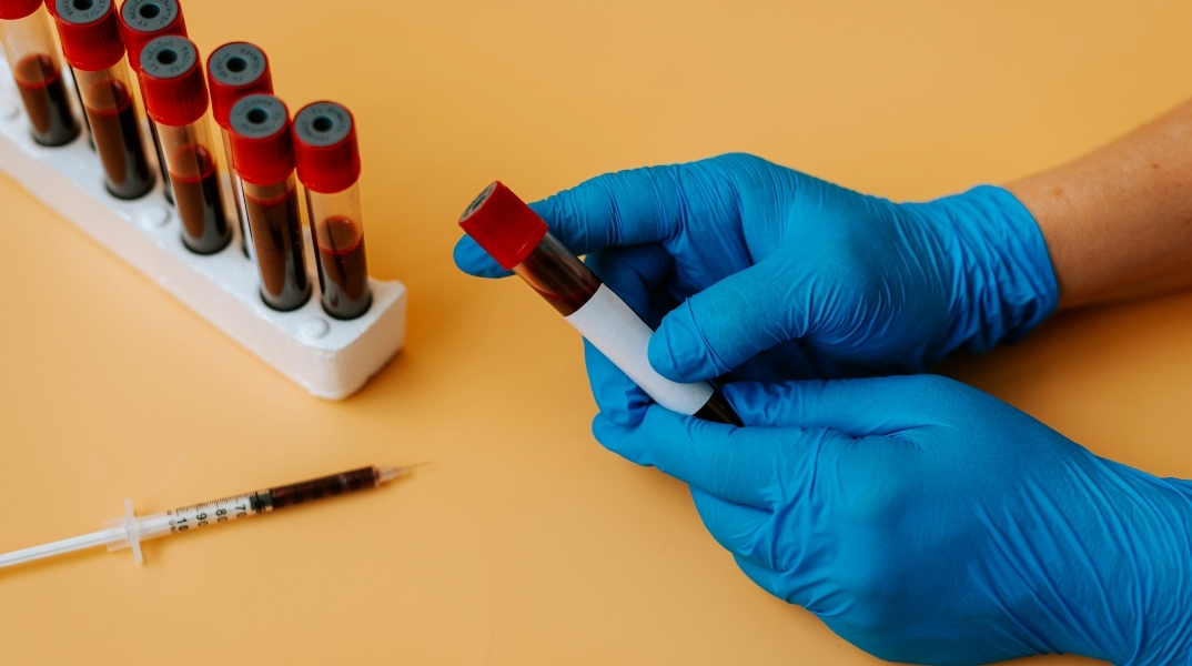 χερι, γαντια, φυαλιδια, αιμα