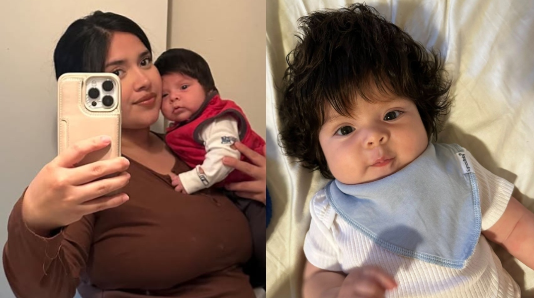 Μπας και είναι περούκα; - Το 5 μηνών μωρό που έγινε viral για την πλούσια κόμη του 