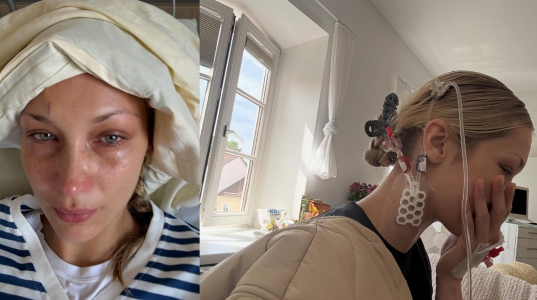 Η σιωπηλή ασθένεια της Μπέλα Χαντίντ: Το χρονικό της μάχης με τη νόσο του Lyme