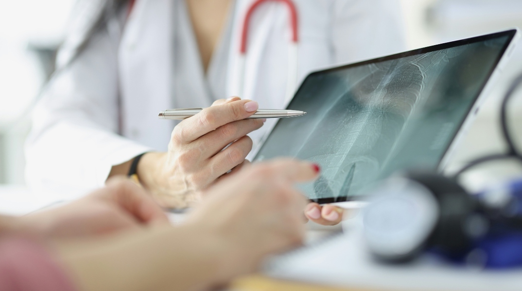 ακτινογραφια θωρακος