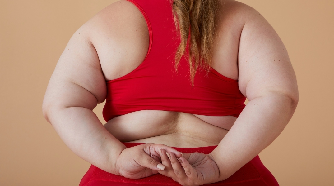 παχυσαρκία