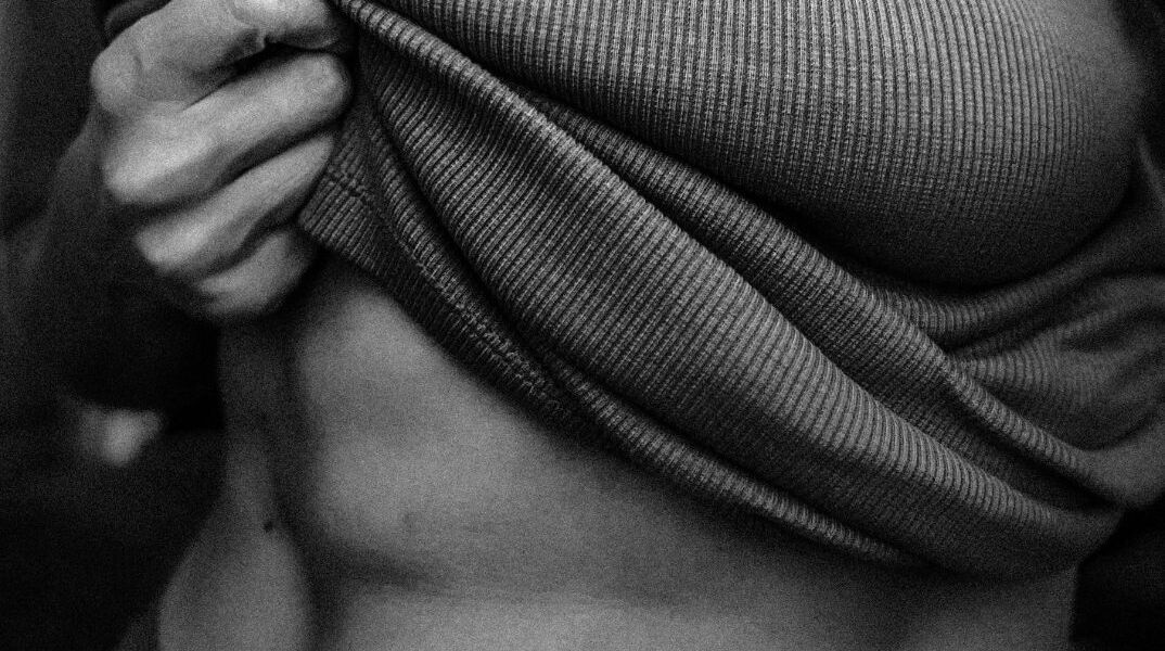 Πλαστική επέμβαση