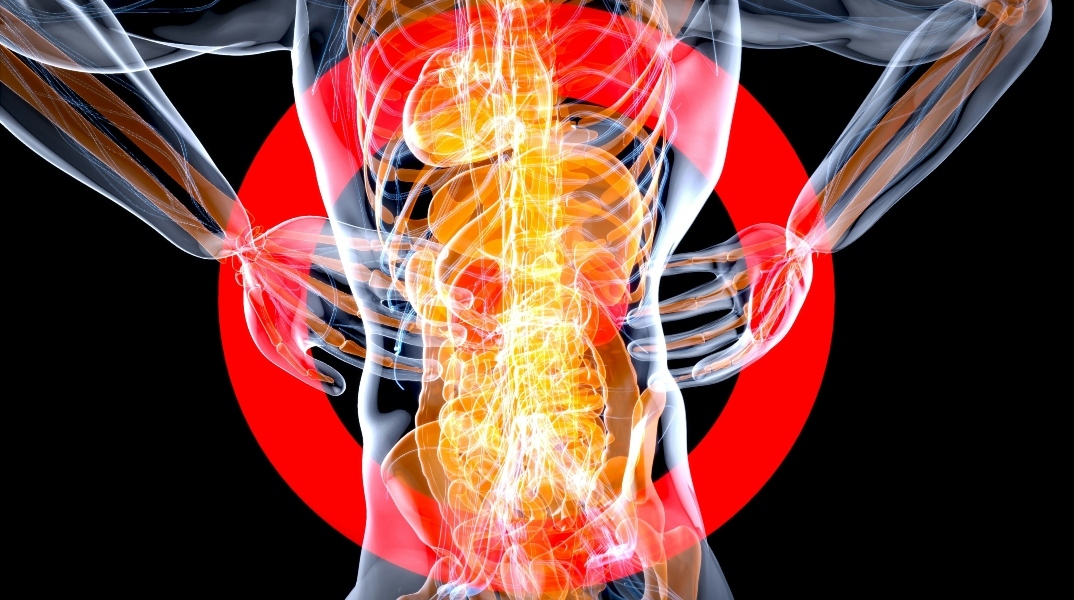 Ένας στους δέκα θα εμφανίσει κάποια μορφή κήλης στη ζωή του - Νέες τεχνικές στη χειρουργική	