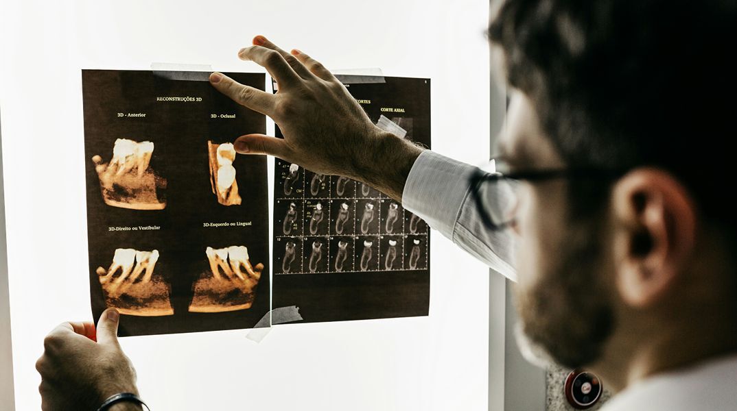 Πέντε ανεπαίσθητα συμπτώματα που οι οδοντίατροι λένε ότι δεν πρέπει ποτέ να αγνοήσετε