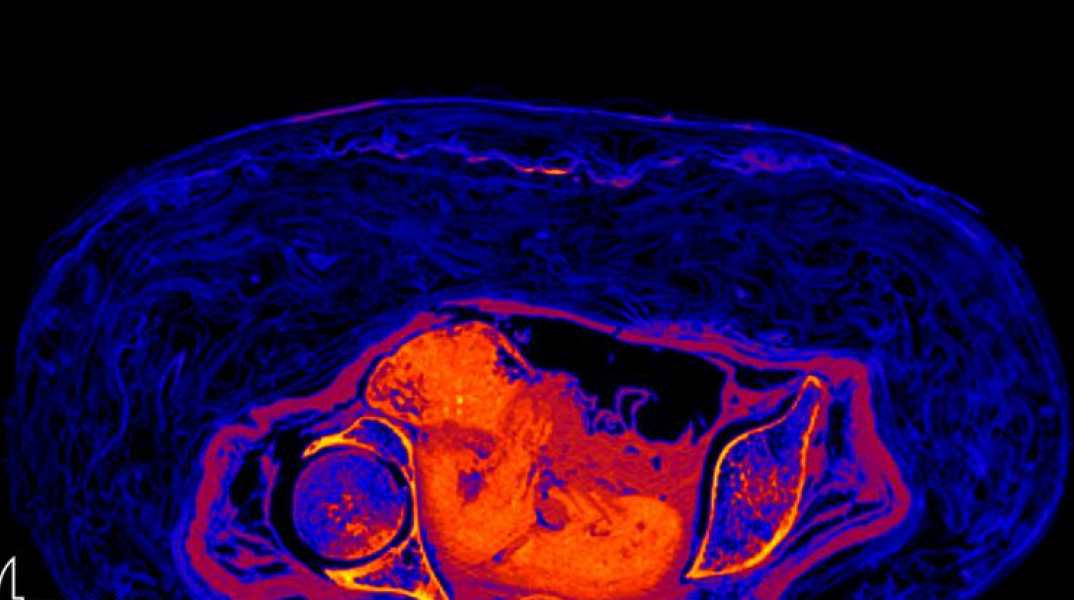 Επιστήμονες δημιούργησαν από βλαστοκύτταρα συνθετικό έμβρυο ποντικιού – Ορόσημο στην αναδημιουργία των πρώτων σταδίων της ζωής