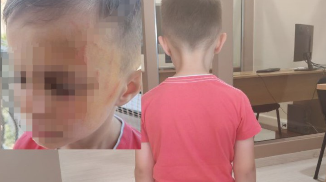 Αγρίνιο: Μητέρα καταγγέλλει τον ξυλοδαρμό του 5χρονου γιου της σε προαύλιο νηπιαγωγείου