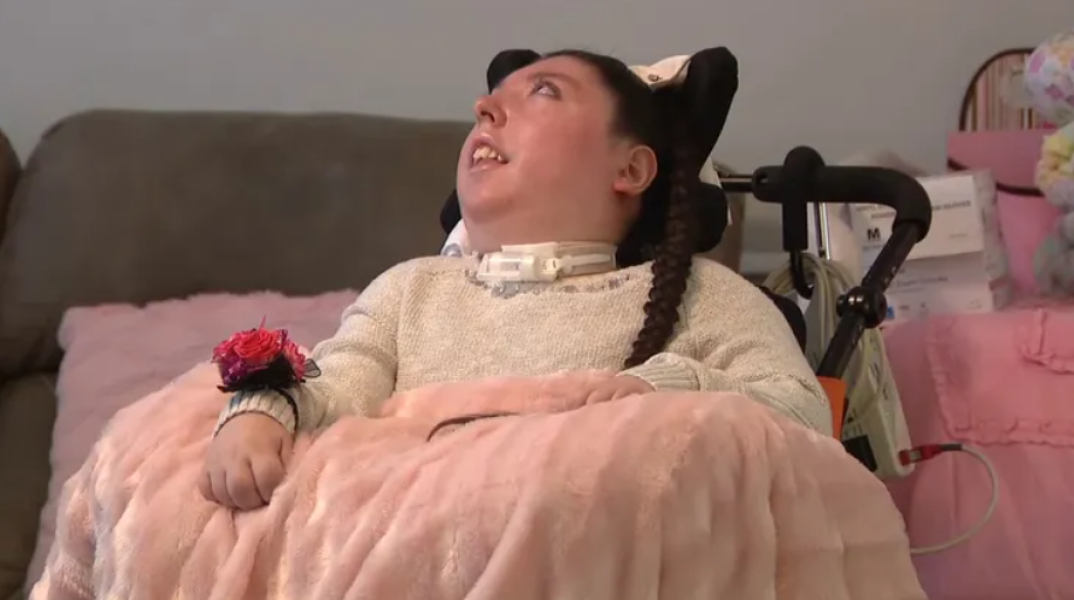 Γυναίκα που γεννήθηκε σχεδόν χωρίς εγκέφαλο έκλεισε τα 20 - Οι γιατροί της έδιναν 4 χρόνια ζωής