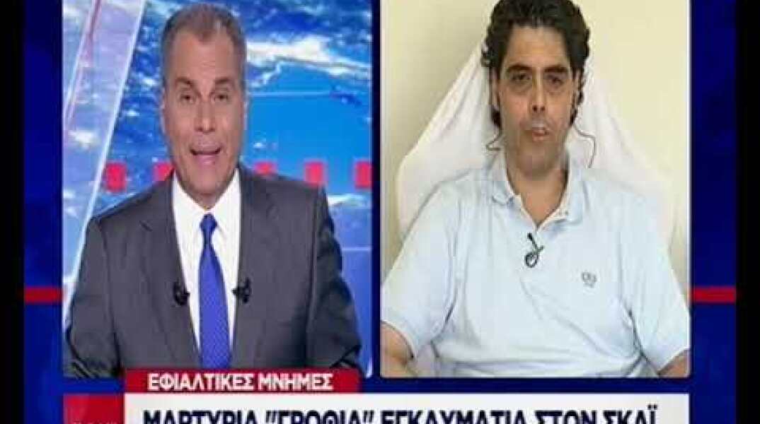 Εγκαυματία