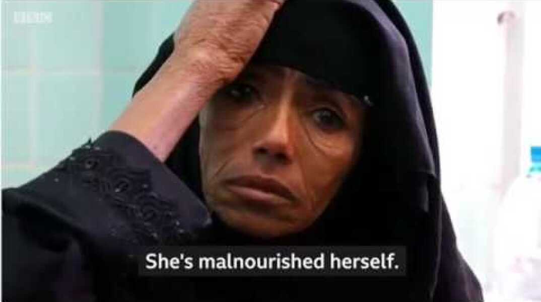 Yemen Could Be 'Worst Famine In 100 Years'