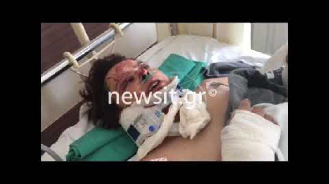 Τροχαίο Πατησίων: Η γυναίκα που τραυματίστηκε