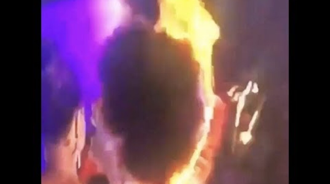Miss Congo’s Wig Catches Fire (Miss Africa 2018)