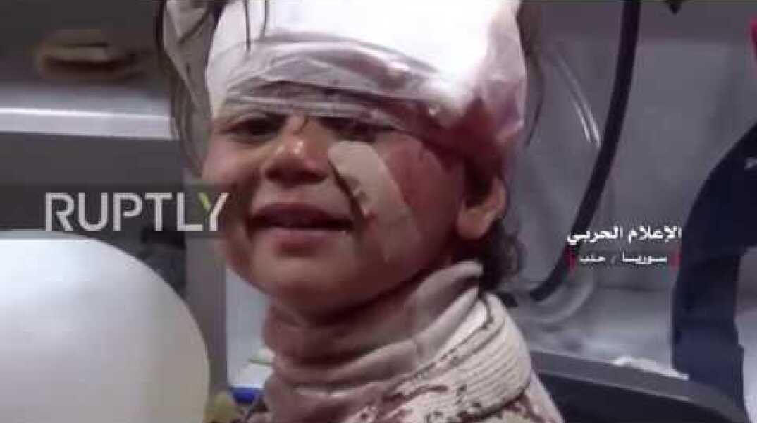 Syria: Child breaks into smile after surviving Saturday’s bus suicide bombing