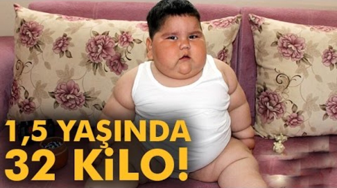 1,5 Yaşında 32 Kilo