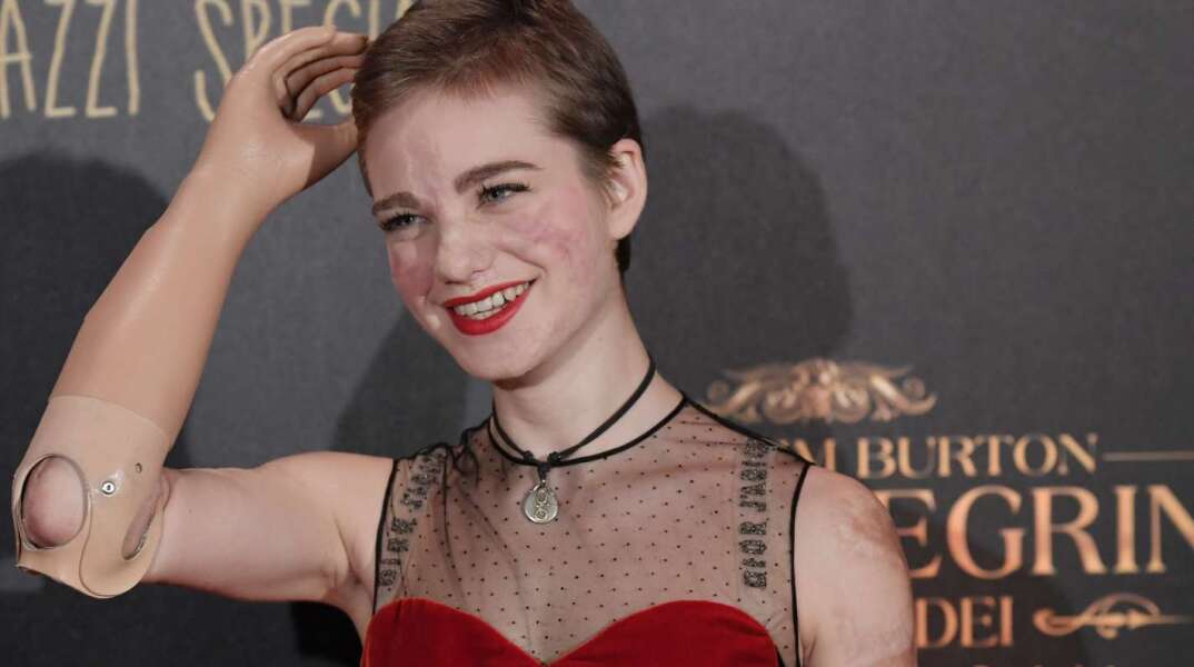 Beatrice Vio