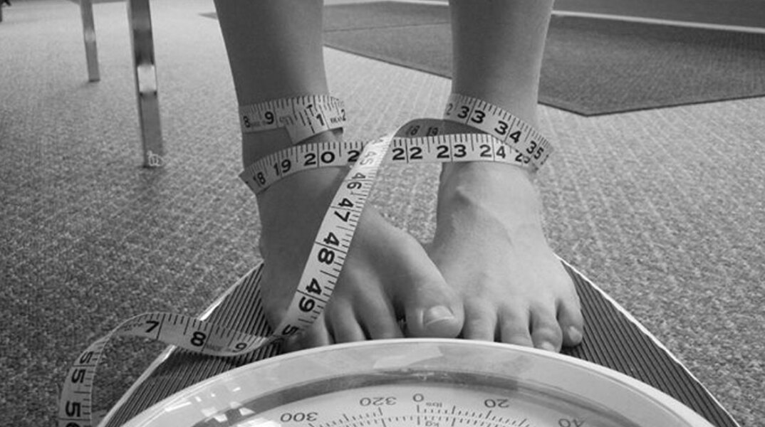 Νευρική ανορεξία