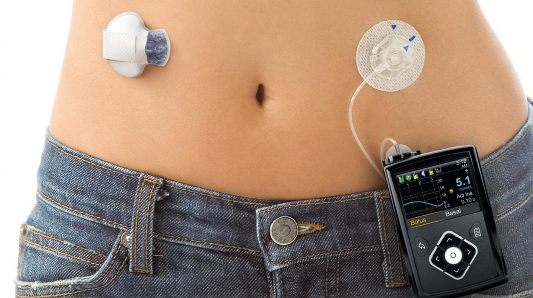 artificial-pancreas-medtronic-fda-medtech.jpg