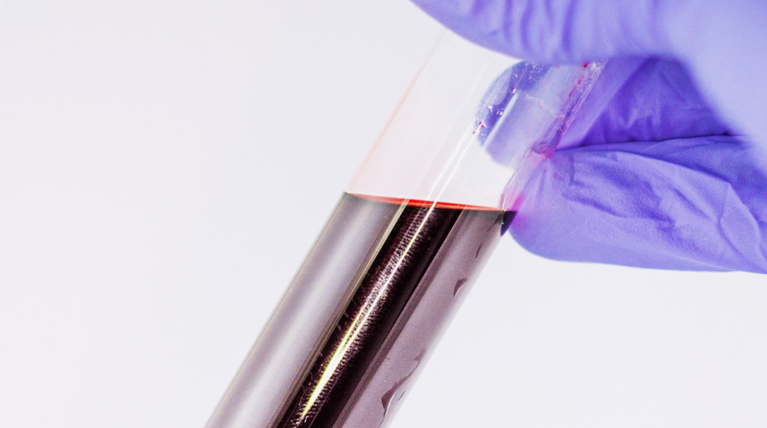 blood-test.jpg