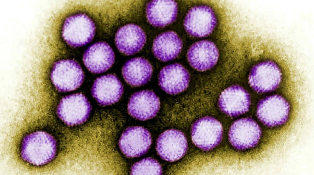 adenovirus-infection.jpg