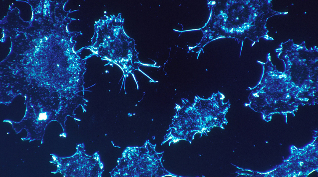 cancer-cells-541954_1920.jpg
