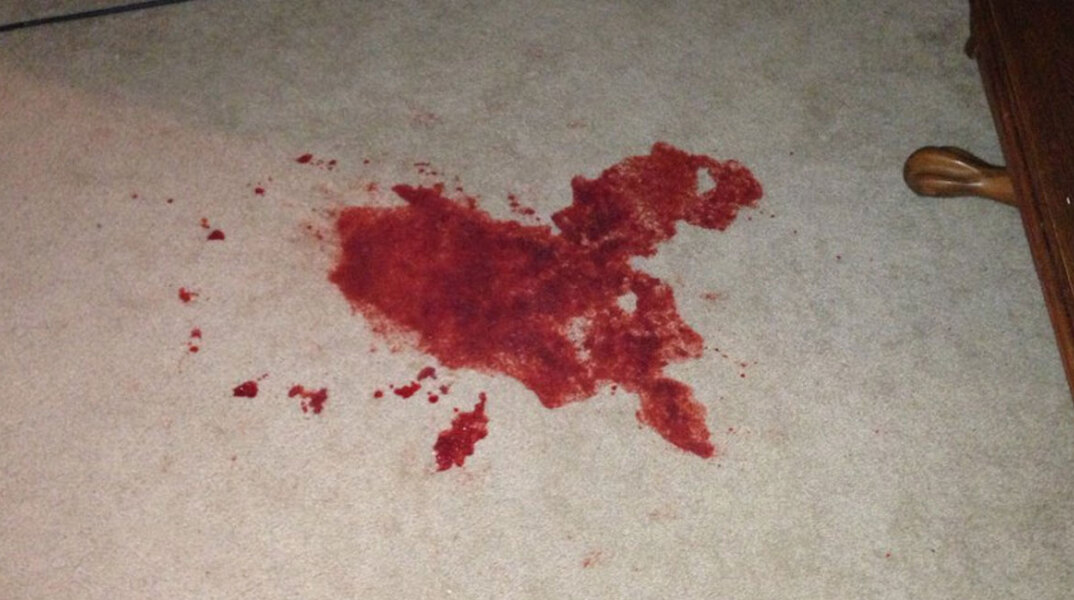 Απόπειρα αυτοκτονίας