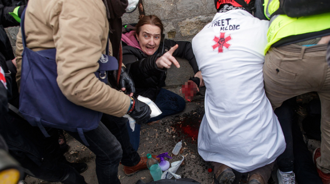 Χειροβομβίδα σκάει στο χέρι διαδηλωτή των Κίτρινων Γιλέκων