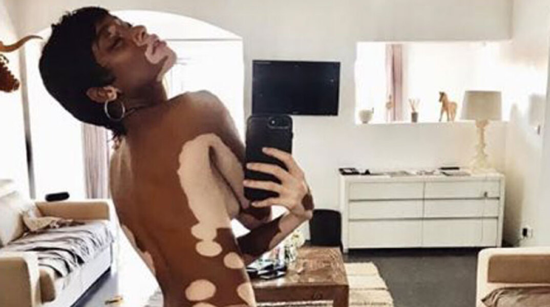 Winnie Harlow για το Sports Illustrated 