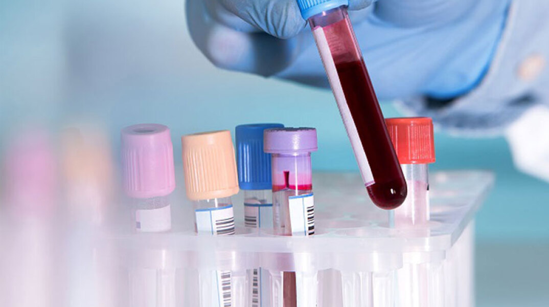 Τεστ αίματος