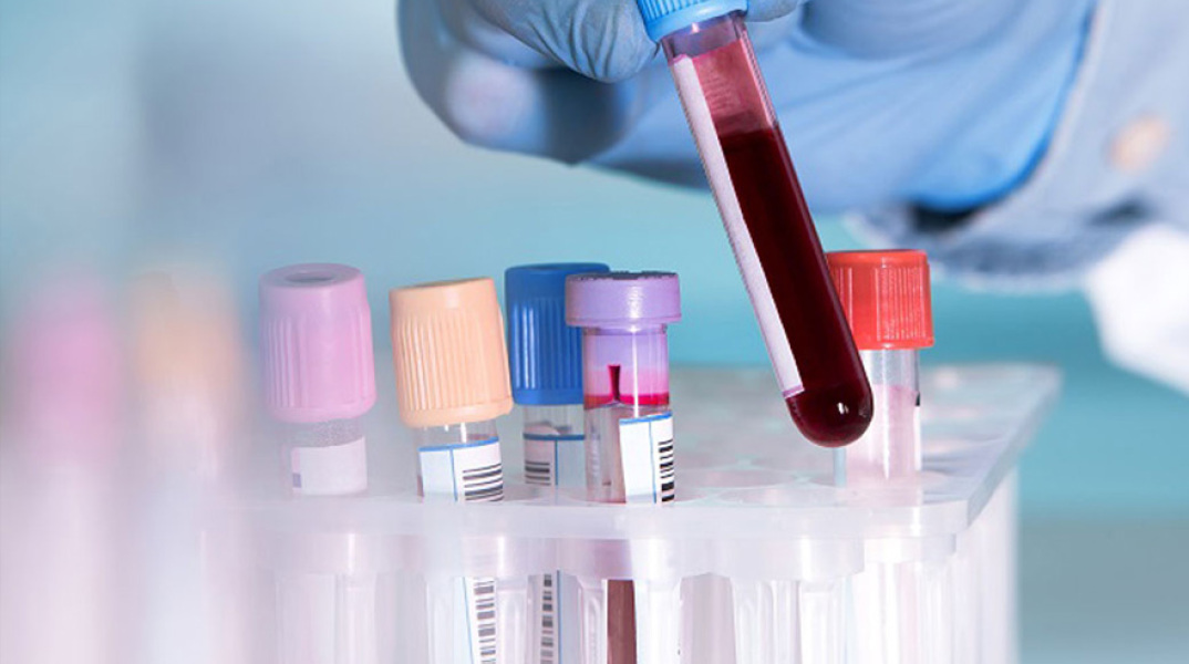 Εξέταση αίματος