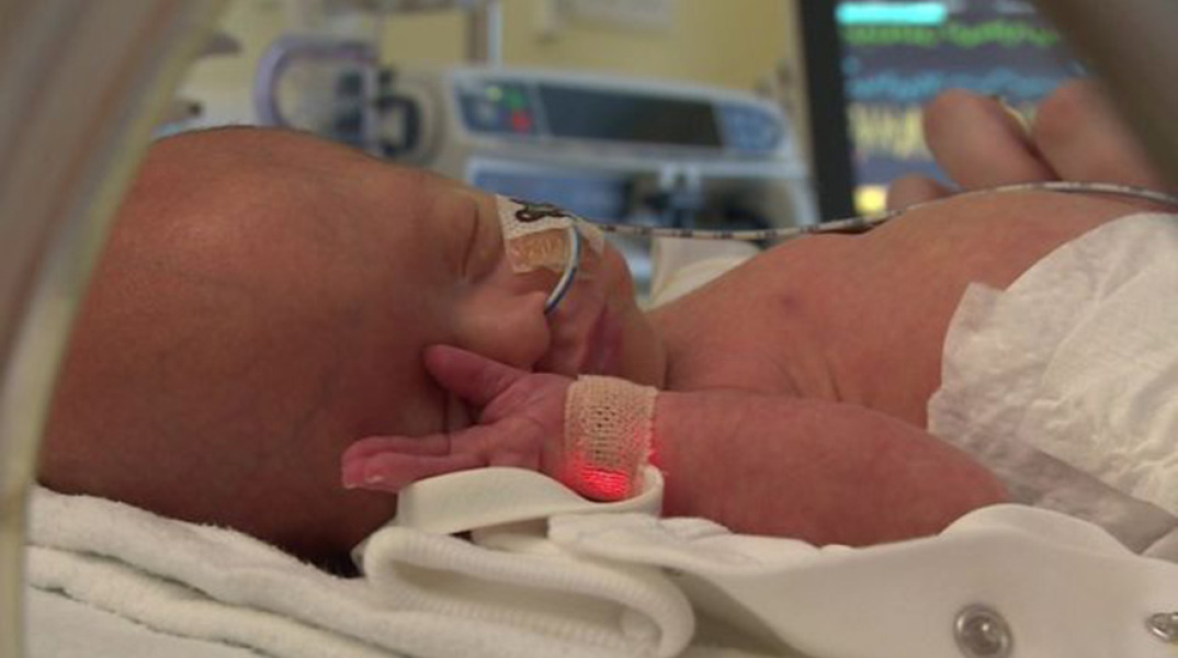 Μωρό Τζάκσον