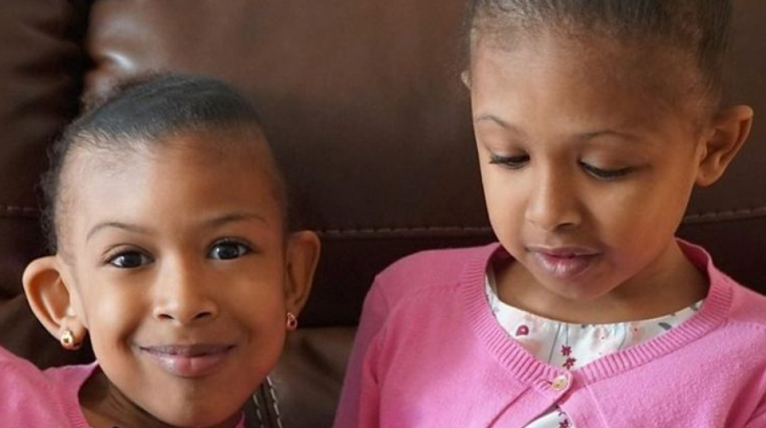 Σιαμαία κοριτσάκια