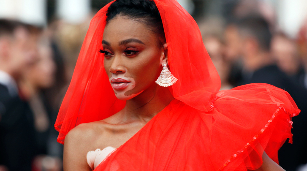 Γουίνι Χάρλοου