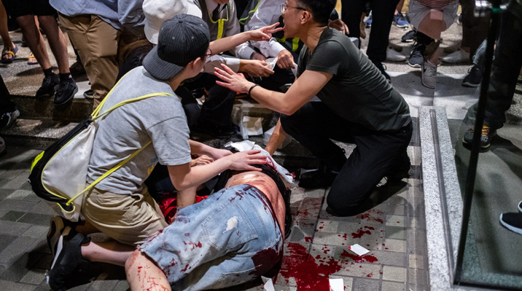Σκληρές εικόνες βίας στο Χονγκ Κονγκ