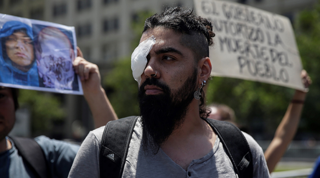 Διαδηλωτές με οφθαλμικά τραύματα στη Χιλή 