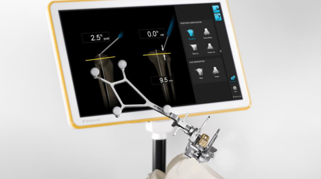 Πρωτοποριακό σύστημα ρομποτικής πλοήγησης στην Ευρωκλινική Αθηνών