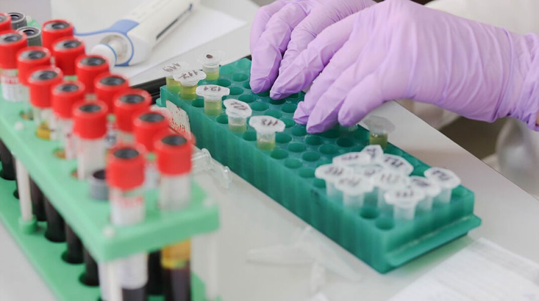 Κύπρος: Συνεχίζονται οι εξετάσεις δειγμάτων για κορωνοϊό