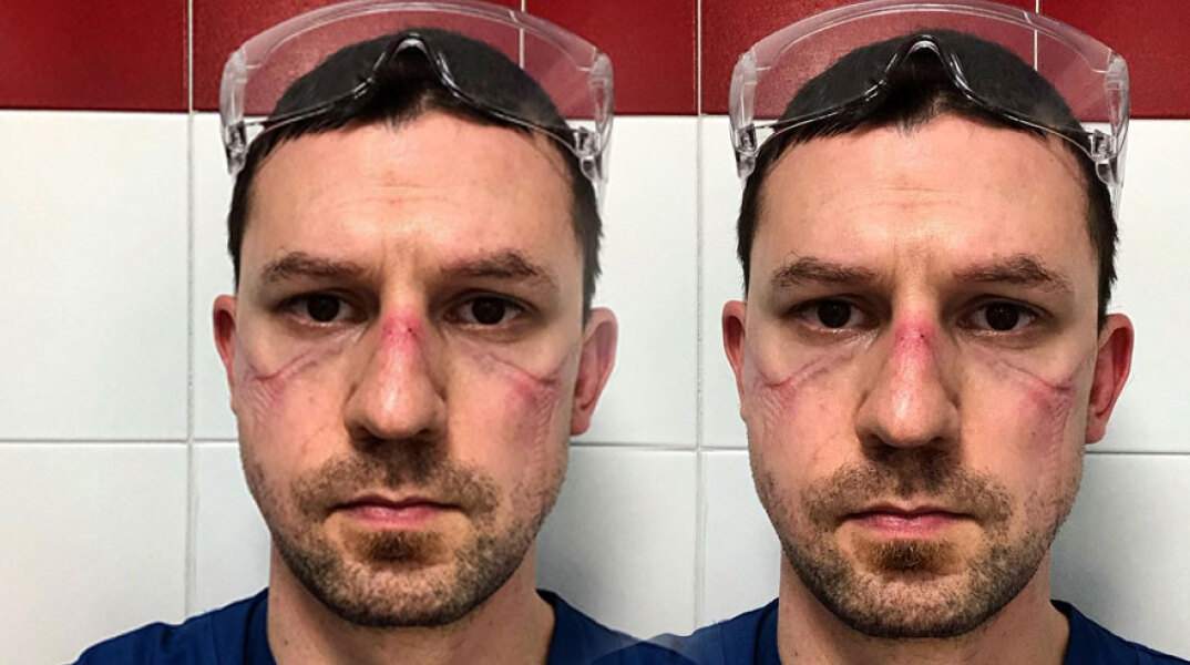 Συγκλονίζει η selfie του Ιταλού γιατρού για τον κορωνοϊό